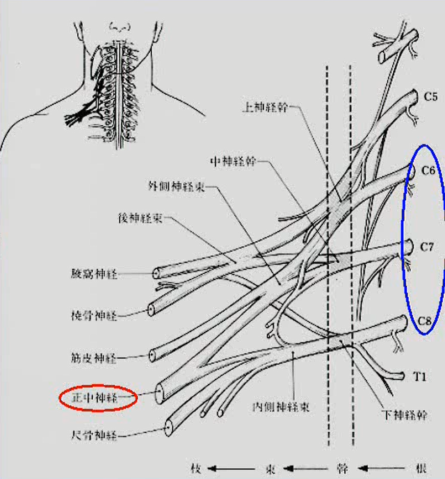 頚髄神経根障害(ラディキュロパシー)