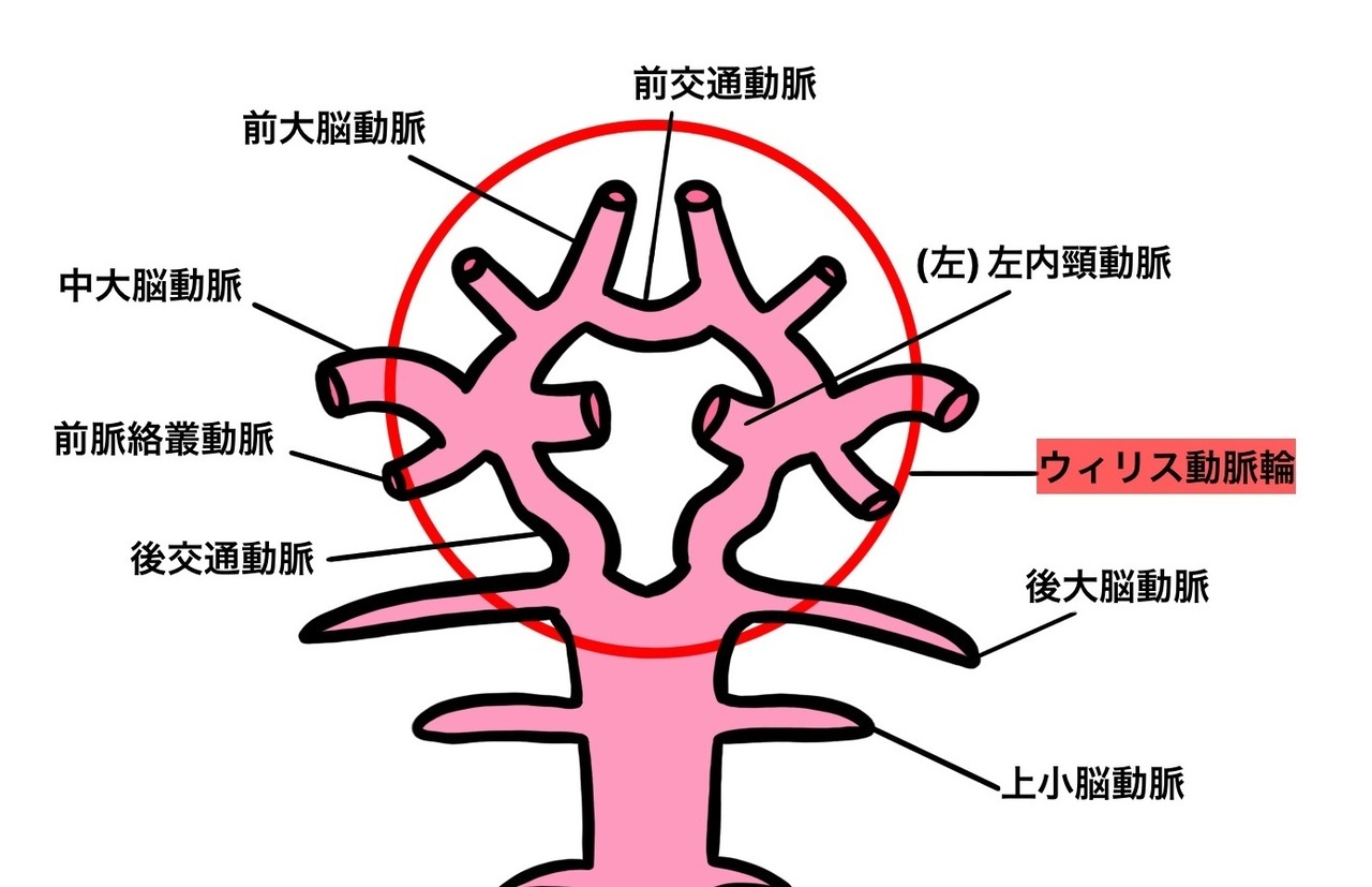 ウィリスの動脈輪