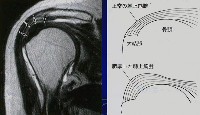 ＭＲＩ