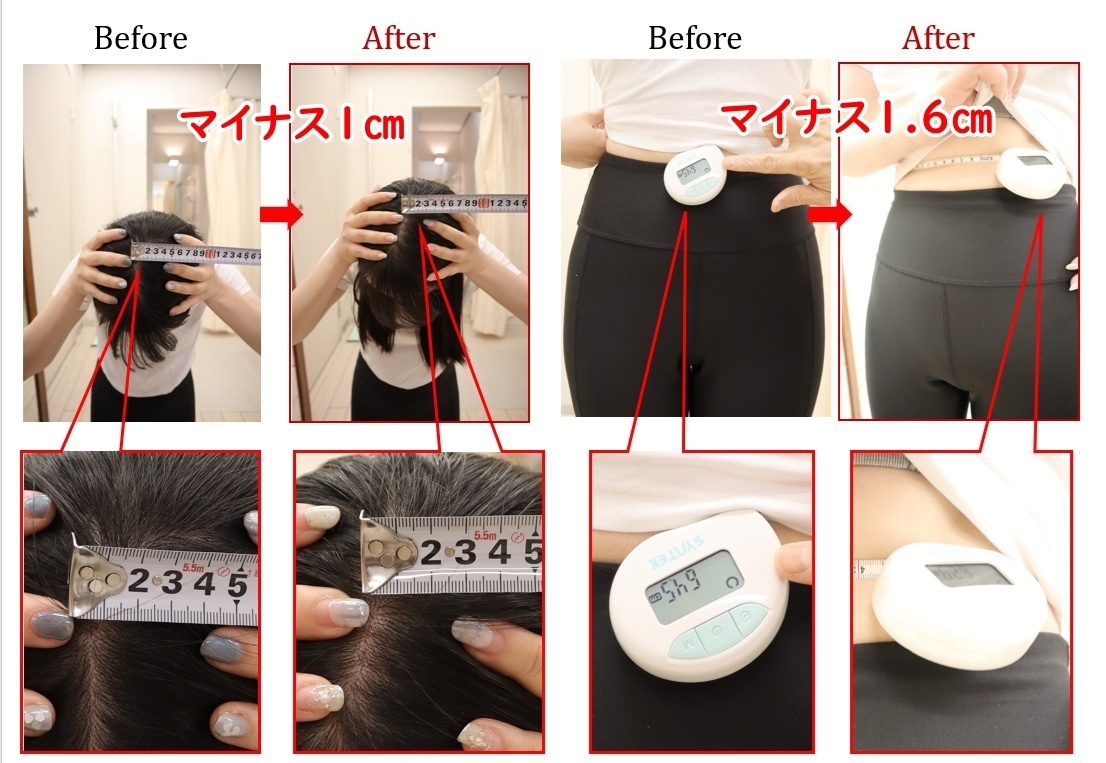 Before After 美容整体