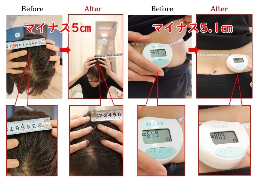 Before After 美容整体