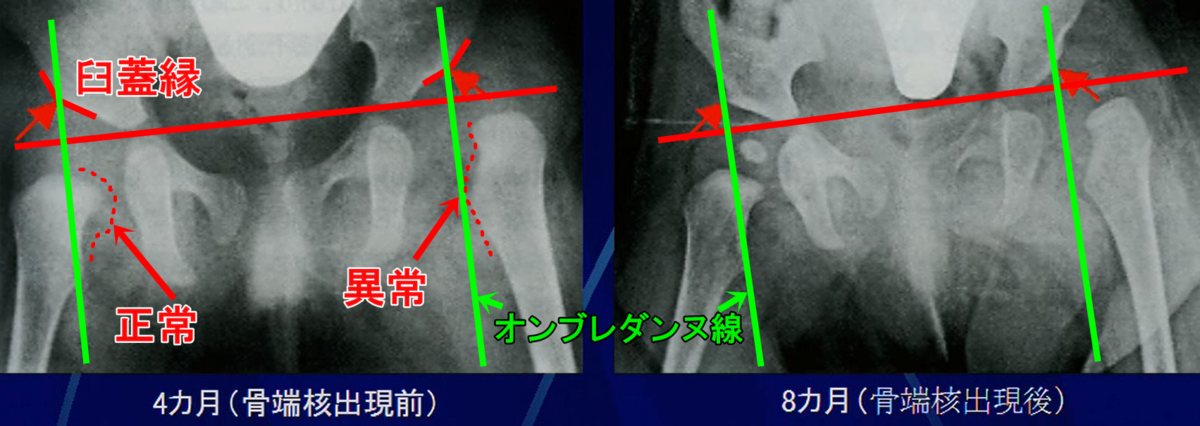 オンブレダンヌ線