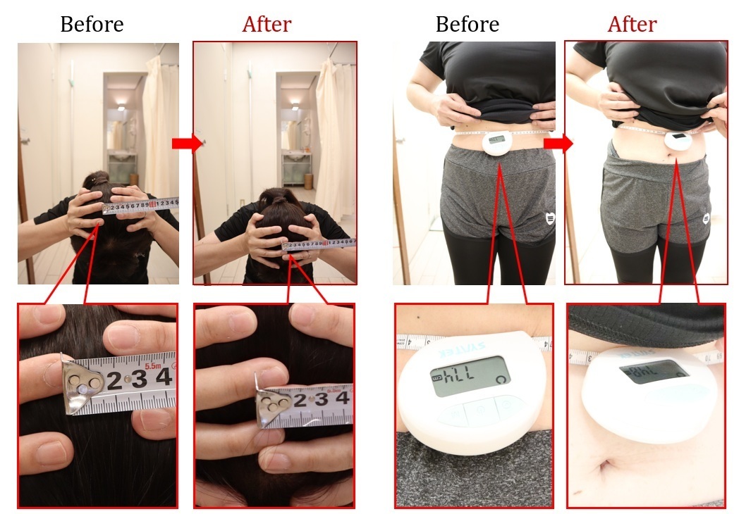 Before After 美容整体