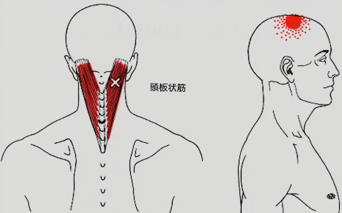 後頚筋群