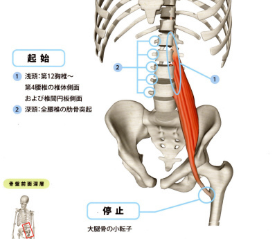 腰痛の原因の筋肉　大腰筋