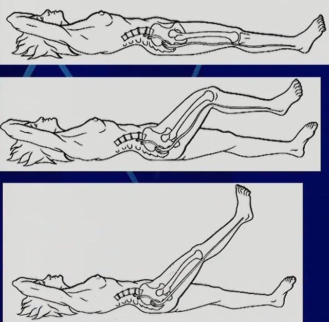 下肢伸展挙上テスト(SLRテスト)　整形外科学テスト　オーソペディックテスト