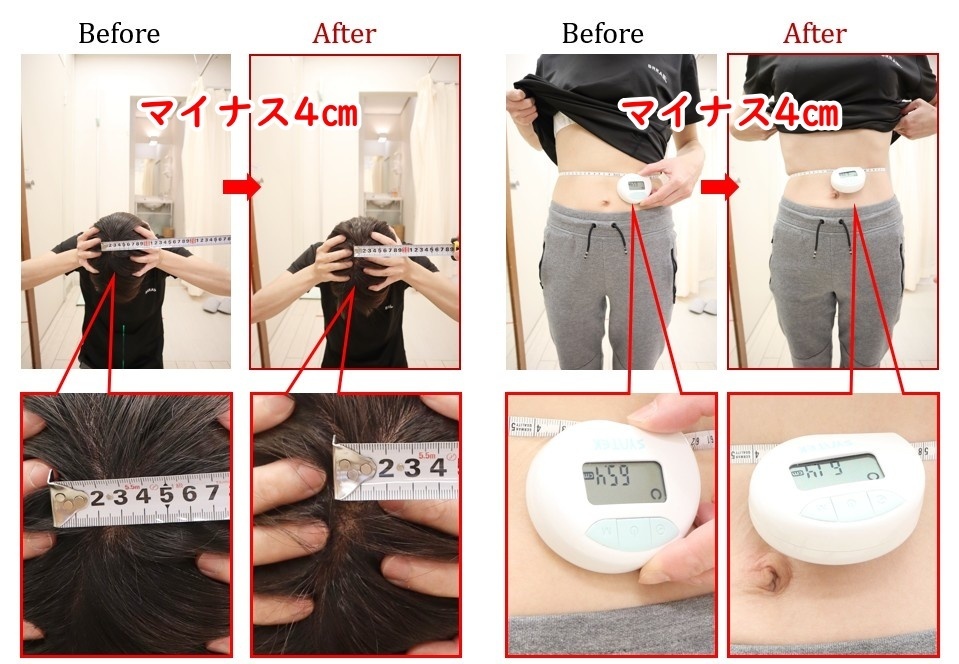 Before After 美容整体