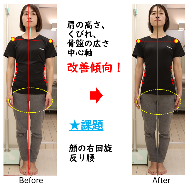 美容整体ビフォーアフター品川区