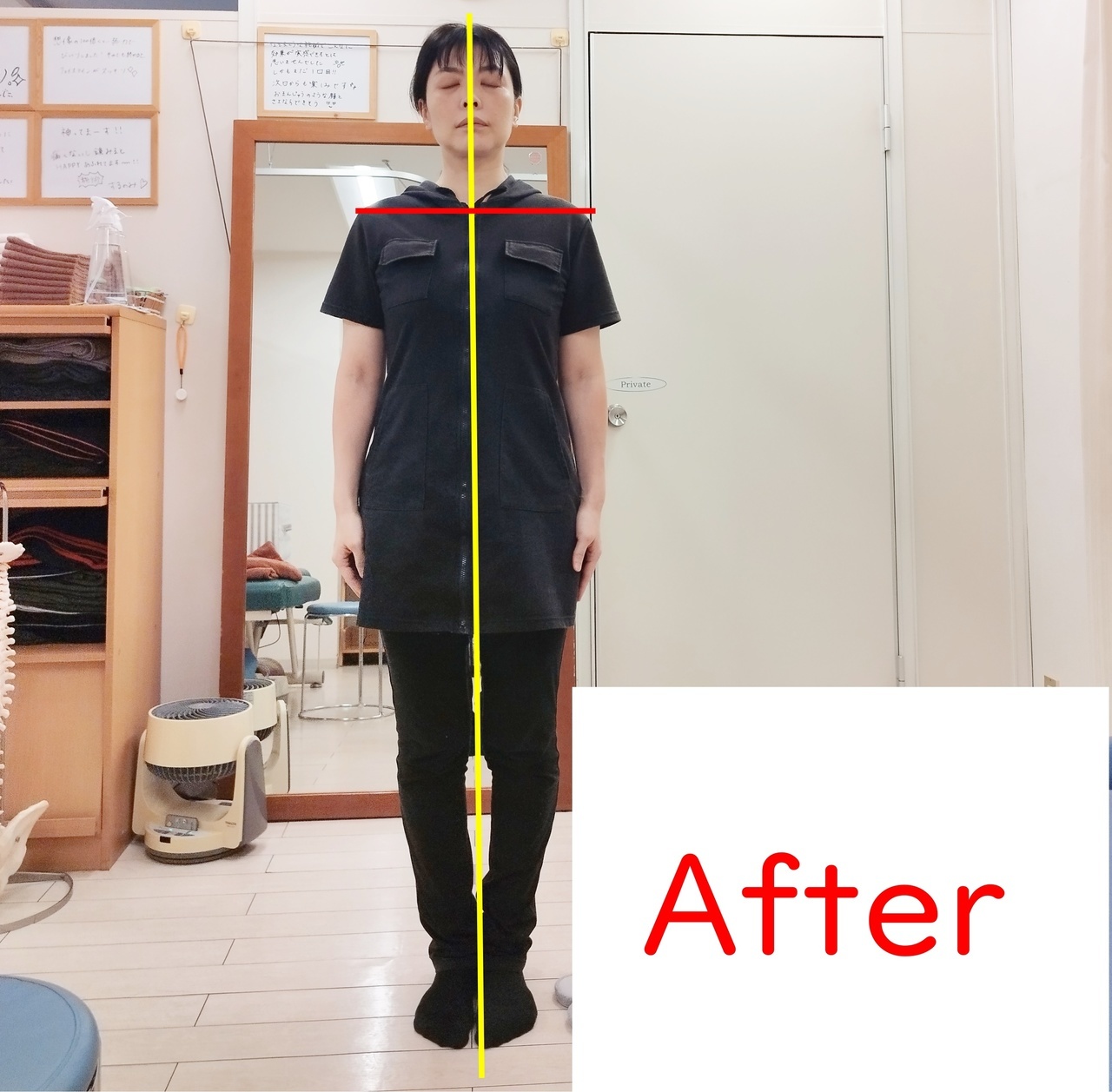 冨田勝RESET 品川区美容整体のアフター立位正面