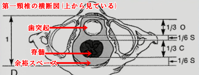 頸椎1番の3分の1ルール