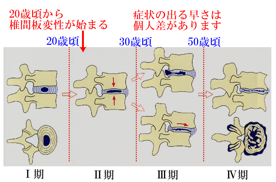 背骨の一生