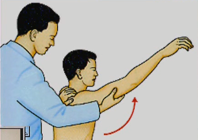 ニーヤの手技(内旋→屈曲) 肩峰下インピンジメント症候群の方は肩関節の内旋し屈曲の動きが激痛となります。 それを検査する方法がニーヤの手技です。