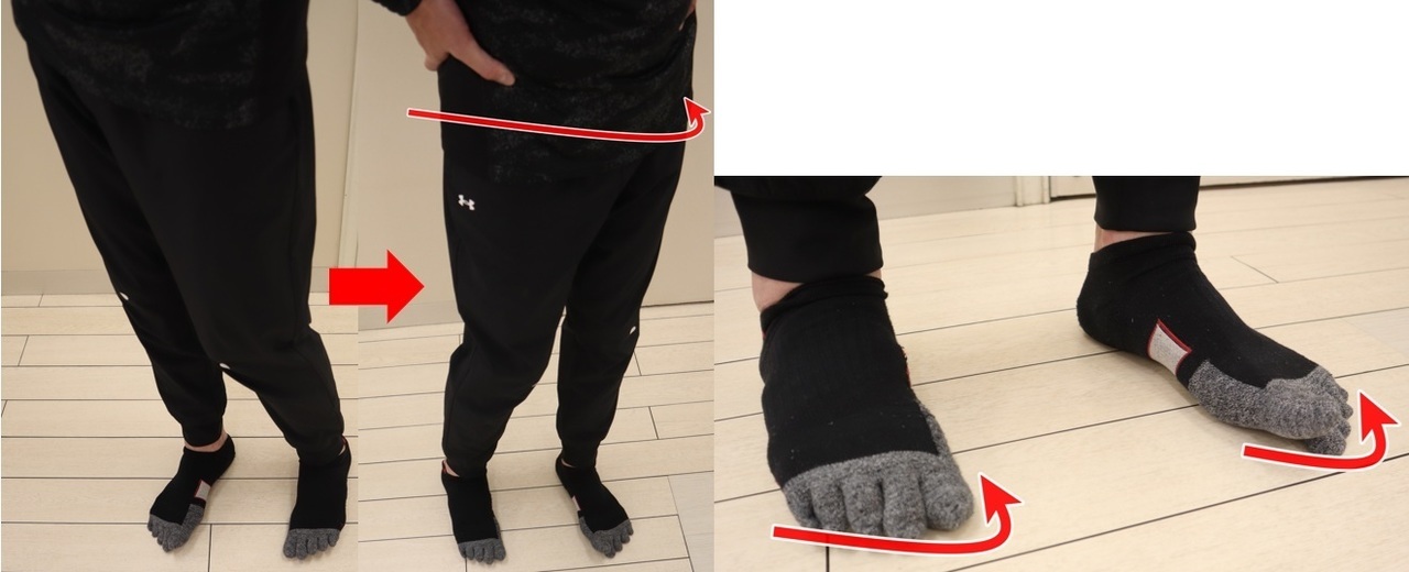 外反母趾の治し方｜姿勢改善と美ボディメイクを叶えるセルフケア