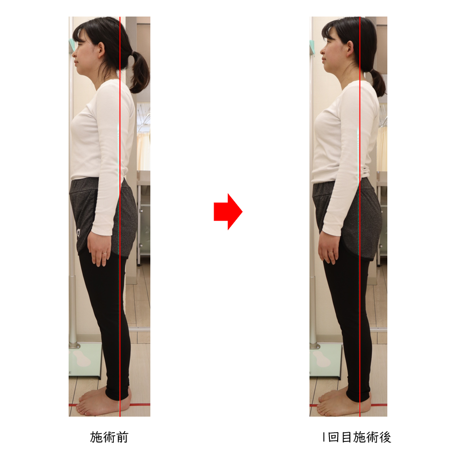 姿勢分析東京