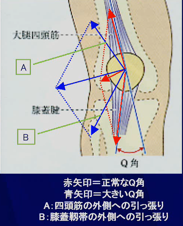 大きいＱ角