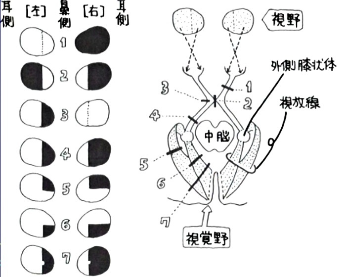 II .視神経（ししんけい）