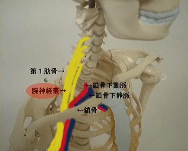 鑑別疾患　胸郭出口症候群