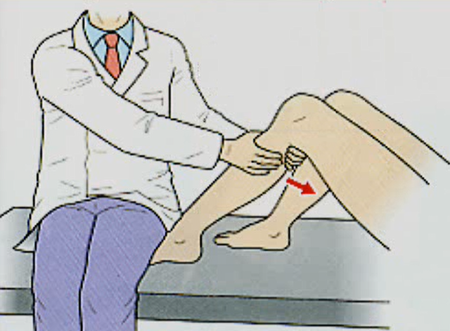 前十字靭帯(ＡＣＬ)損傷の診断