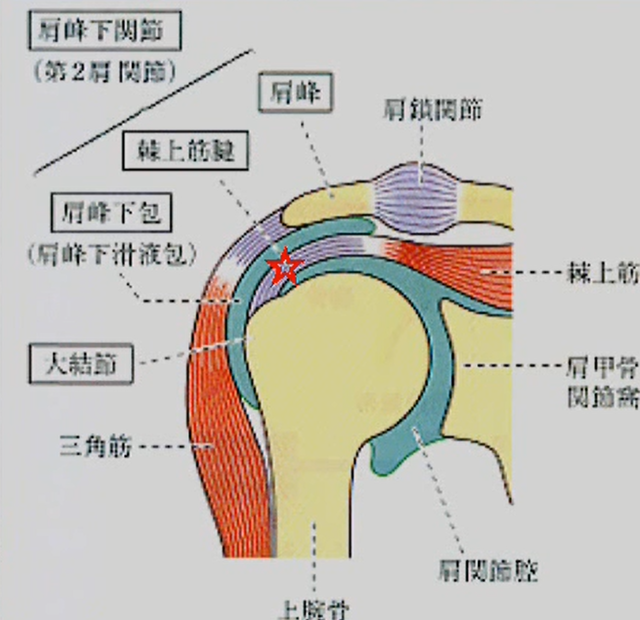 棘上筋腱