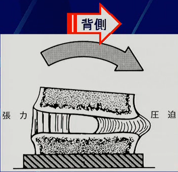 整形外科的テスト　ジャクソンテスト