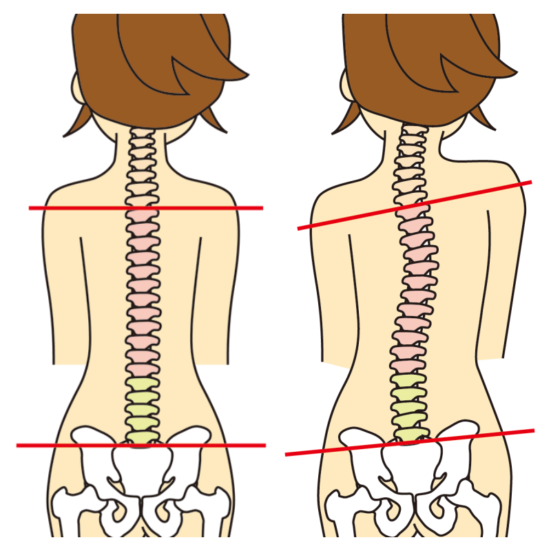 なぜ骨盤の歪みがダイエットの敵なのか？