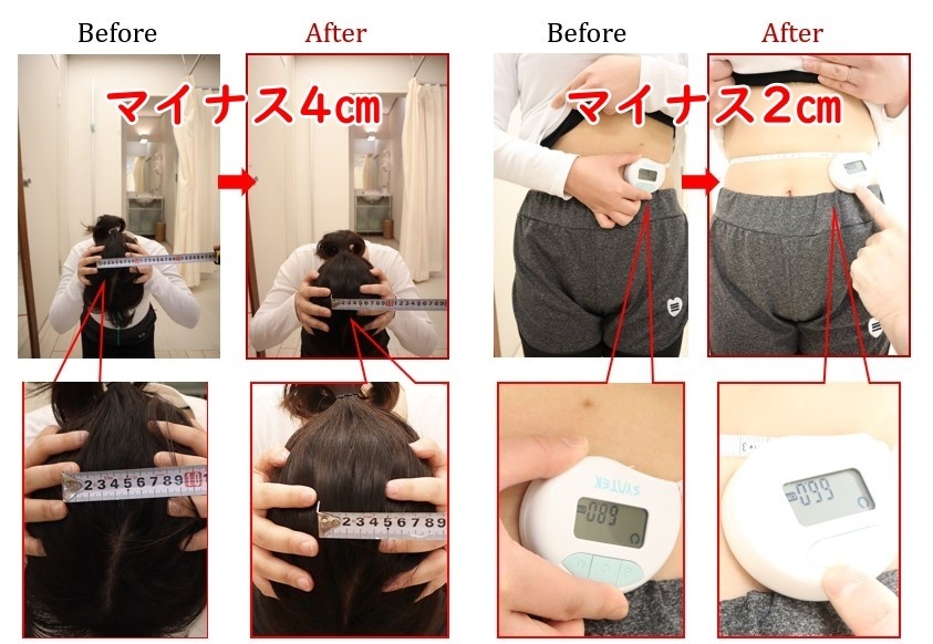 Before After 美容整体