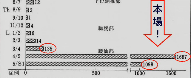 疫学(好発年齢と発生高位について)