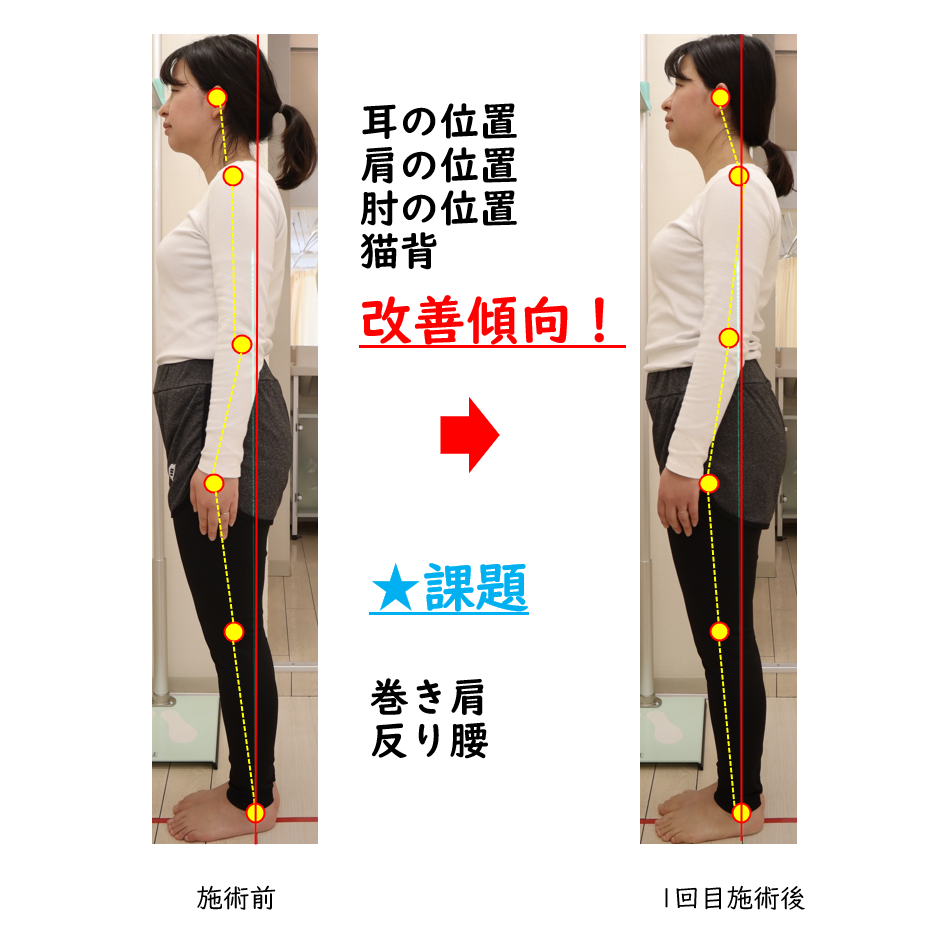 美容整体ビフォーアフター品川区