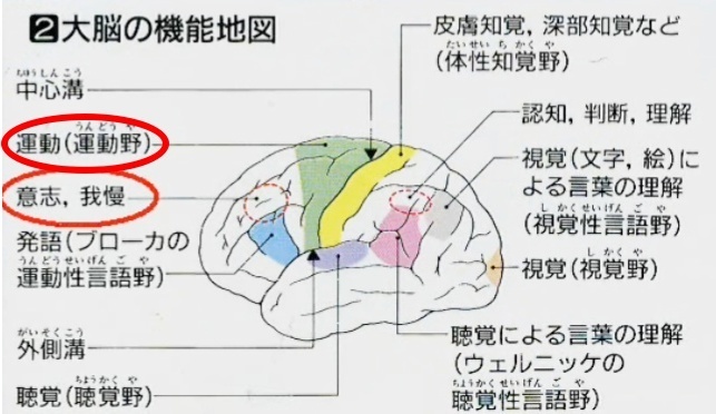 脳梗塞　前大脳動脈が詰まった場合