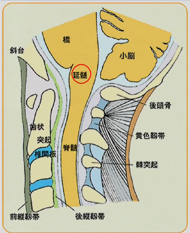 頭蓋底陥入症