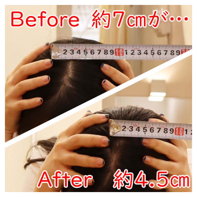 頭蓋骨矯正ビフォーアフター品川区