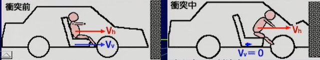 後頭骨と頸椎1番の脱臼