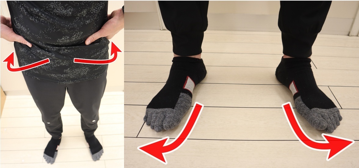 外反母趾の治し方｜姿勢改善と美ボディメイクを叶えるセルフケア