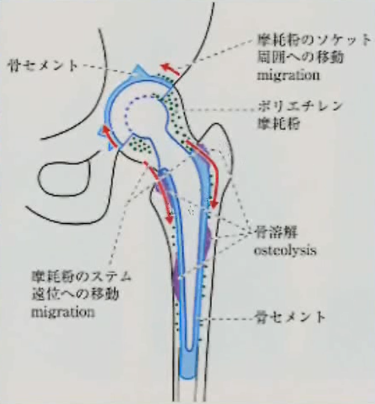 弛み