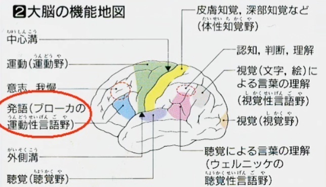 脳梗塞　中大脳動脈が詰まった場合