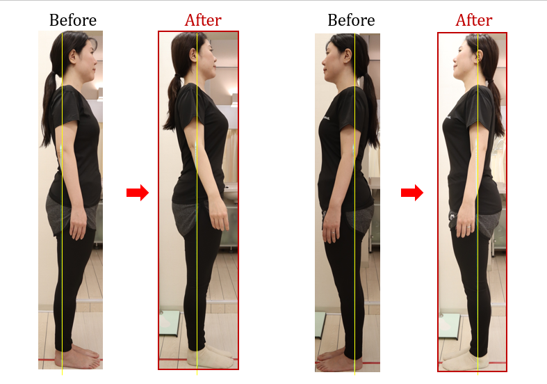 Before After 美容整体