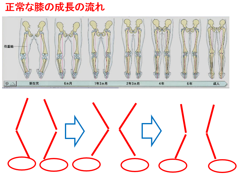 正常な膝の成長の流れ