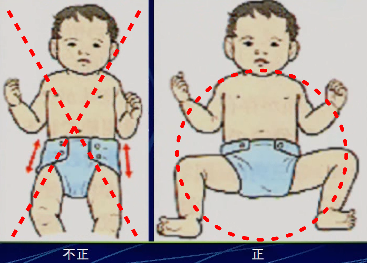 出産後のオムツの仕方