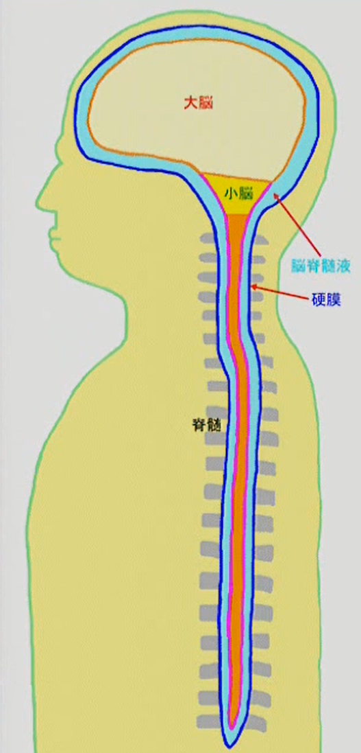 間欠性跛行