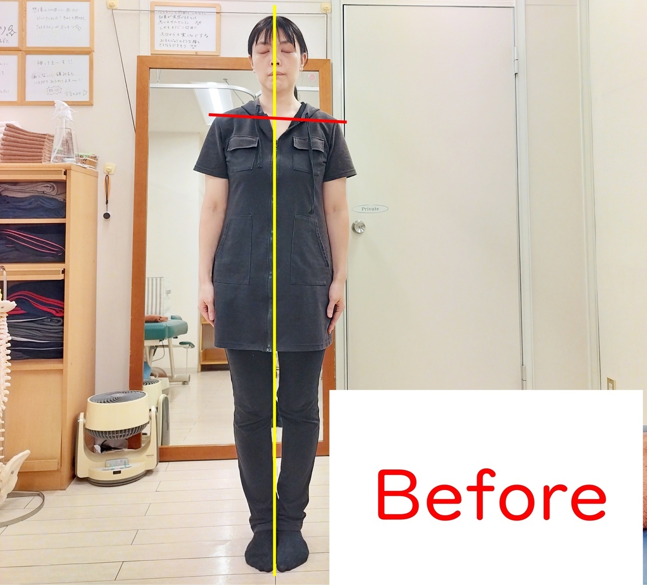 冨田勝RESET 品川区美容整体のビフォー立位正面