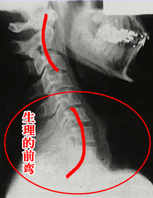 生理的前わん