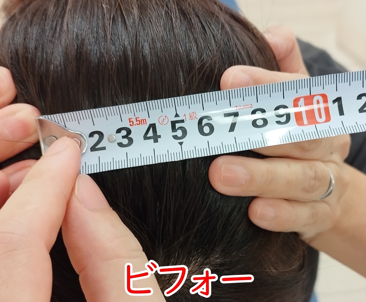 冨田勝RESET 品川区美容整体のビフォー立位正面
