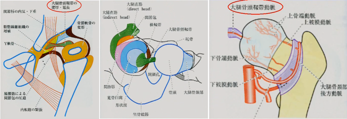 大腿骨頭靭帯