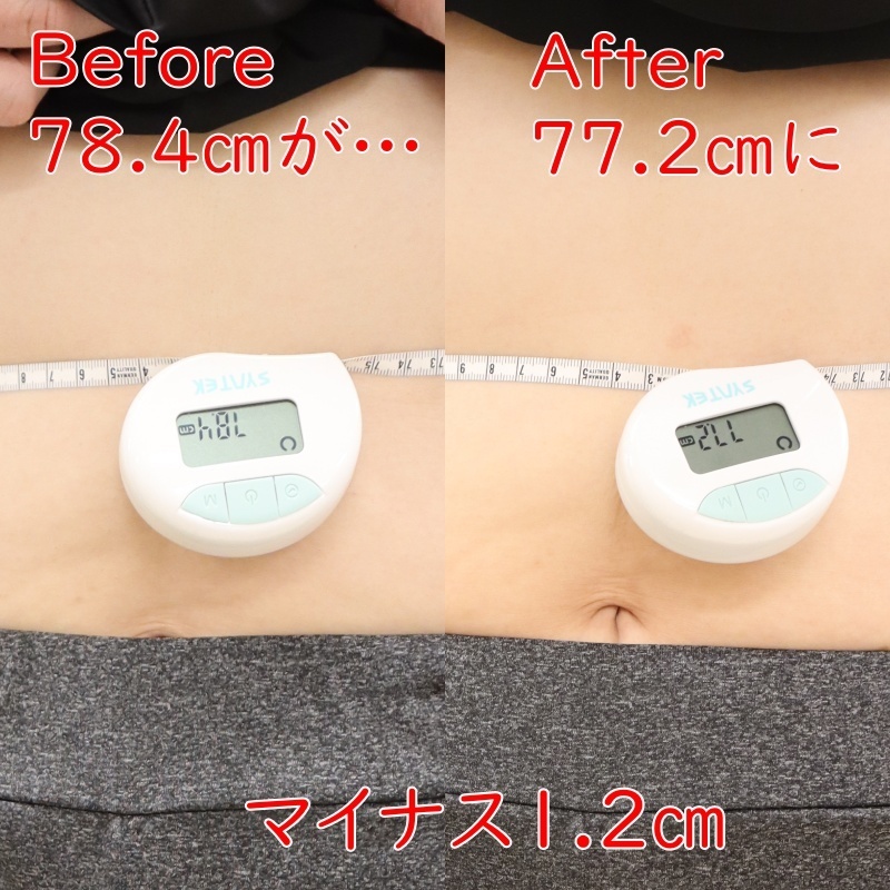 仙骨矯正ビフォーアフター品川区