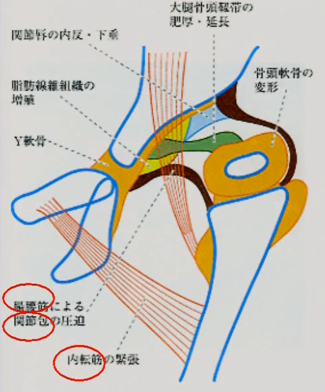 整復障害因子