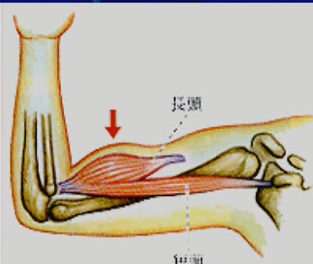 上腕二頭筋長頭腱