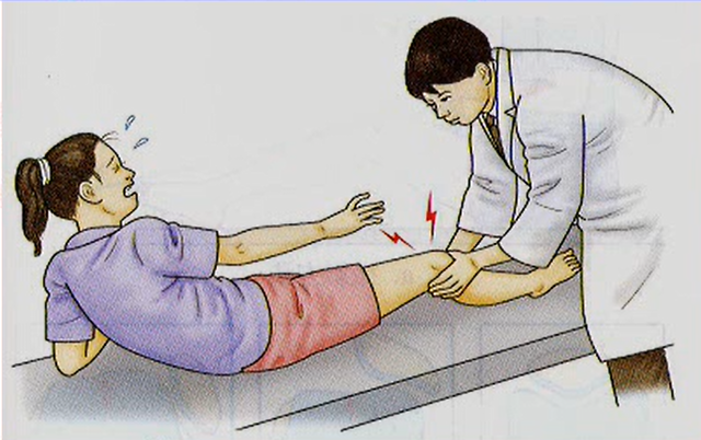 膝蓋骨の脱臼(反復性)