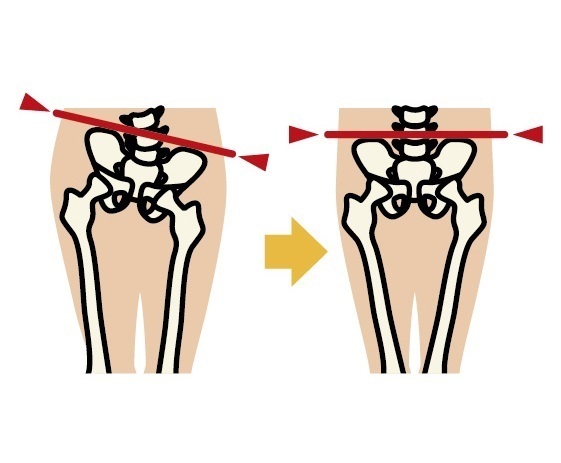 骨盤矯正、産後の骨盤矯正