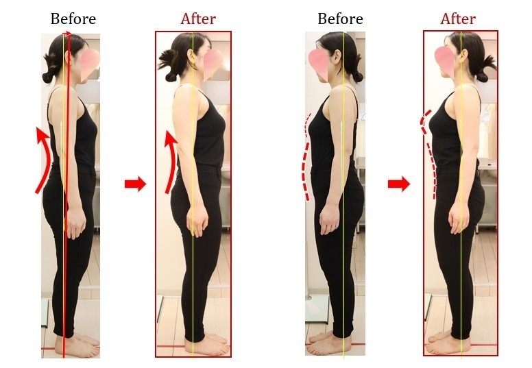 Before After 美容整体