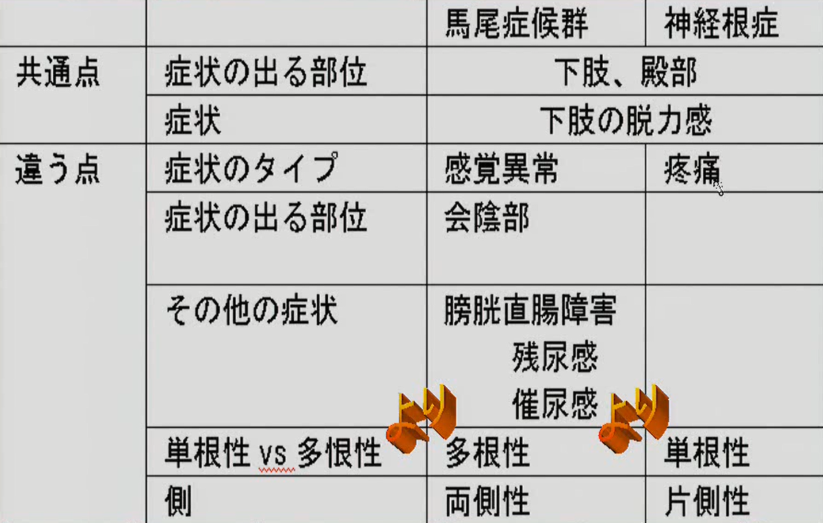 馬尾症候群と神経根症の区別